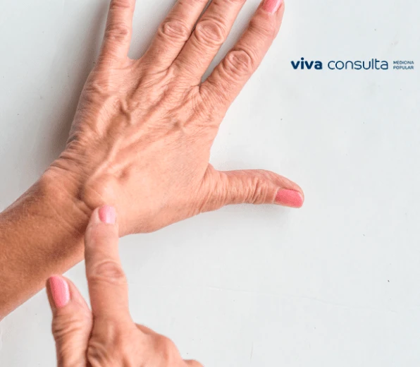 O que &eacute; um Cisto seb&aacute;ceo?